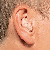 ITE hearing aid from Dr. Maresca at Hearing and Tinnitus Management, LLC